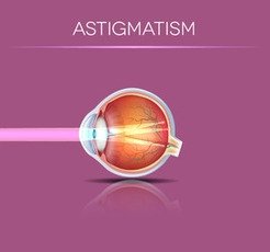 astigmatism