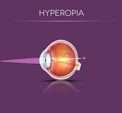 hyperopia