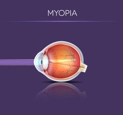 myopia