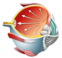 glaucoma treatment wakefield ma